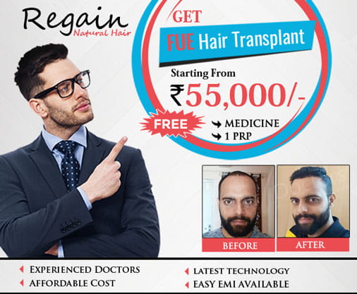 Hair Transplant in Bangalore, Hair Transplant Clinics & Cost Bangalore