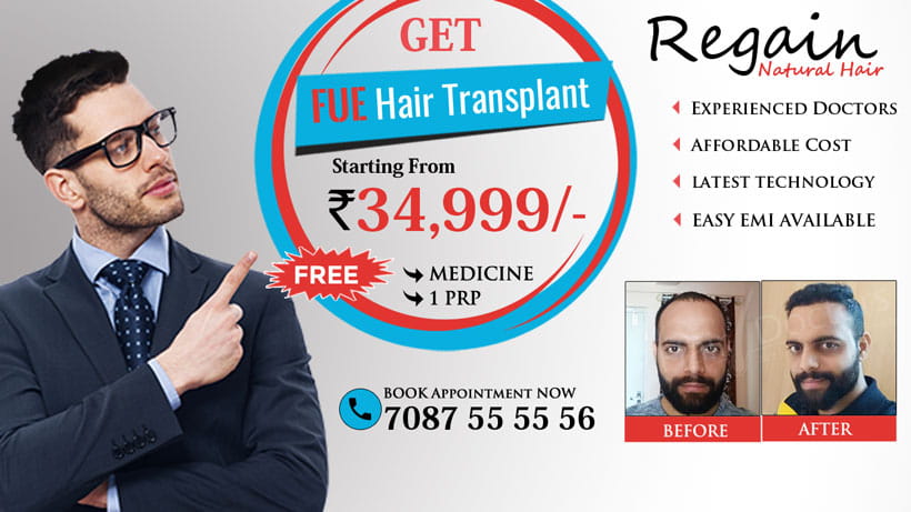 Hair Transplant in Bangalore, Hair Transplant Clinics & Cost Bangalore