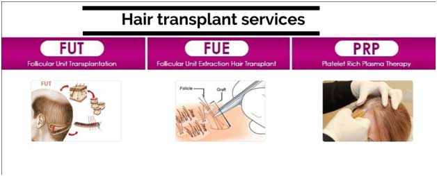 Best Hair Transplant Clinic in Varanasi Best Cost  Top surgeon  best hair  transplant clinic in India